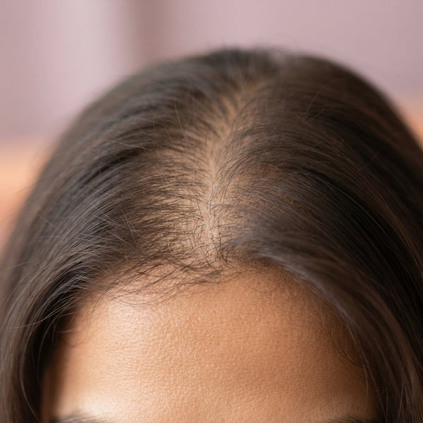 Close-up of a person's scalp showing a hair part with visible thinning and dryness to illustrate hair follicle dormancy.